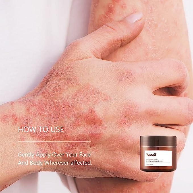 Yanail Anti Fungal Body Cream,60ml