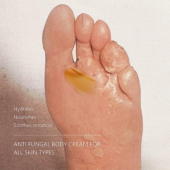 Yanail Anti Fungal Body Cream,60ml