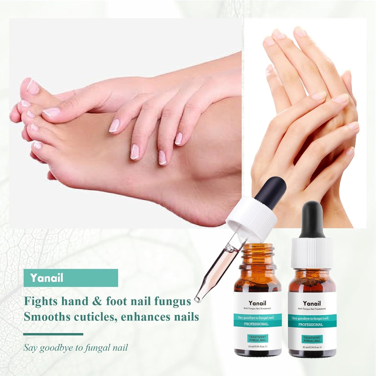 Yanail Fungal Nail Treatment for Toenail