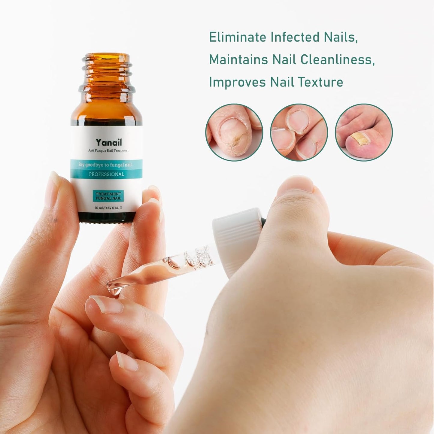 Yanail Fungal Nail Treatment & Antifungal Cream for Toenail