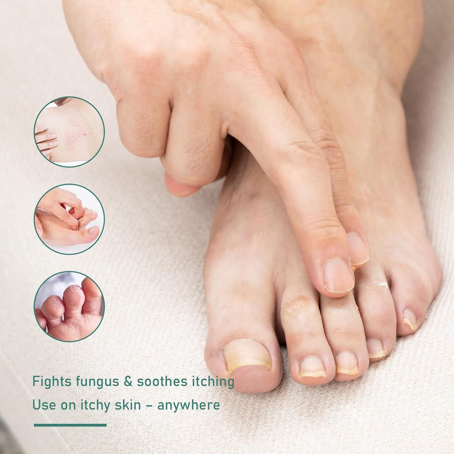 Yanail Fungal Nail Treatment & Antifungal Cream for Toenail